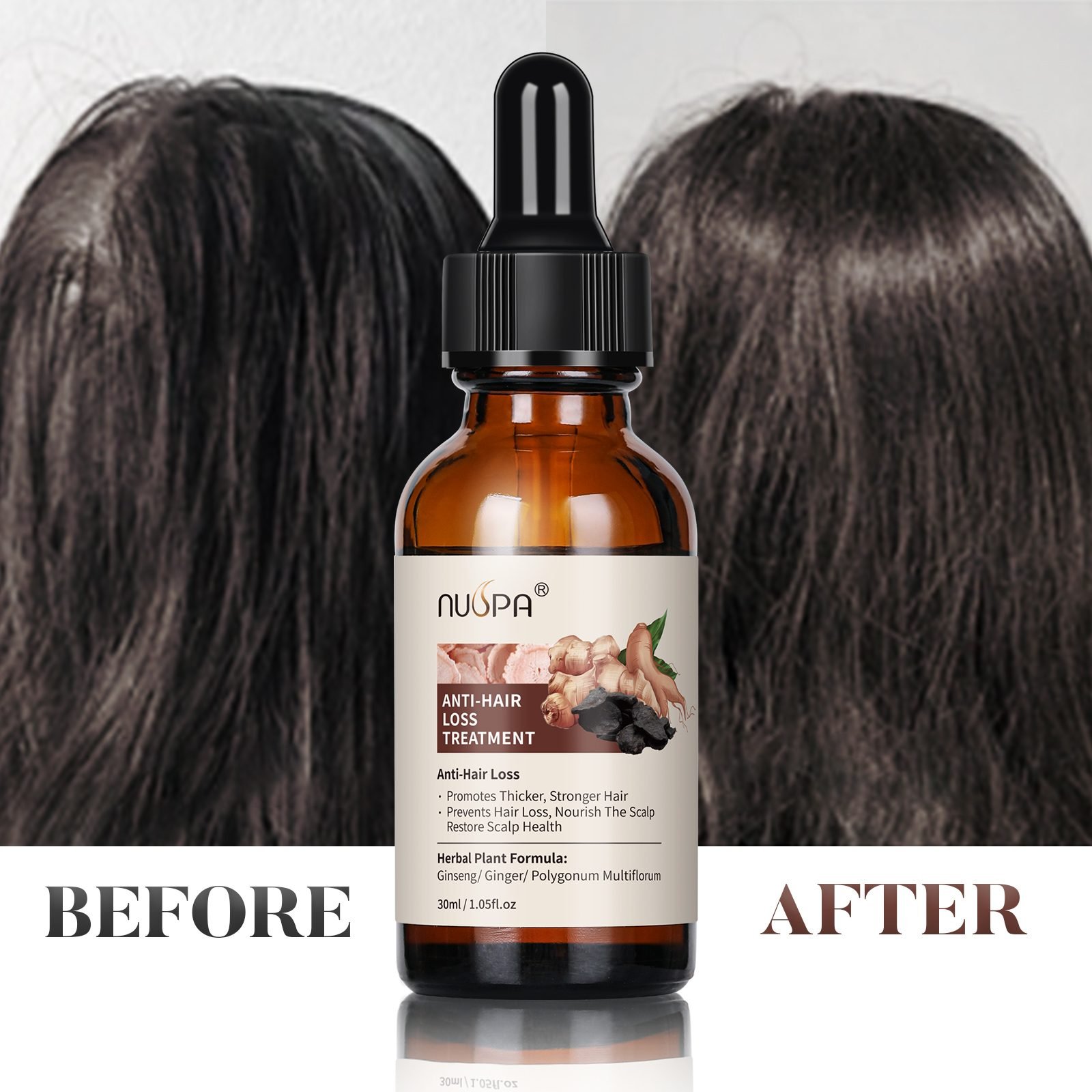 Anti-Hair-Loss Treatment Series