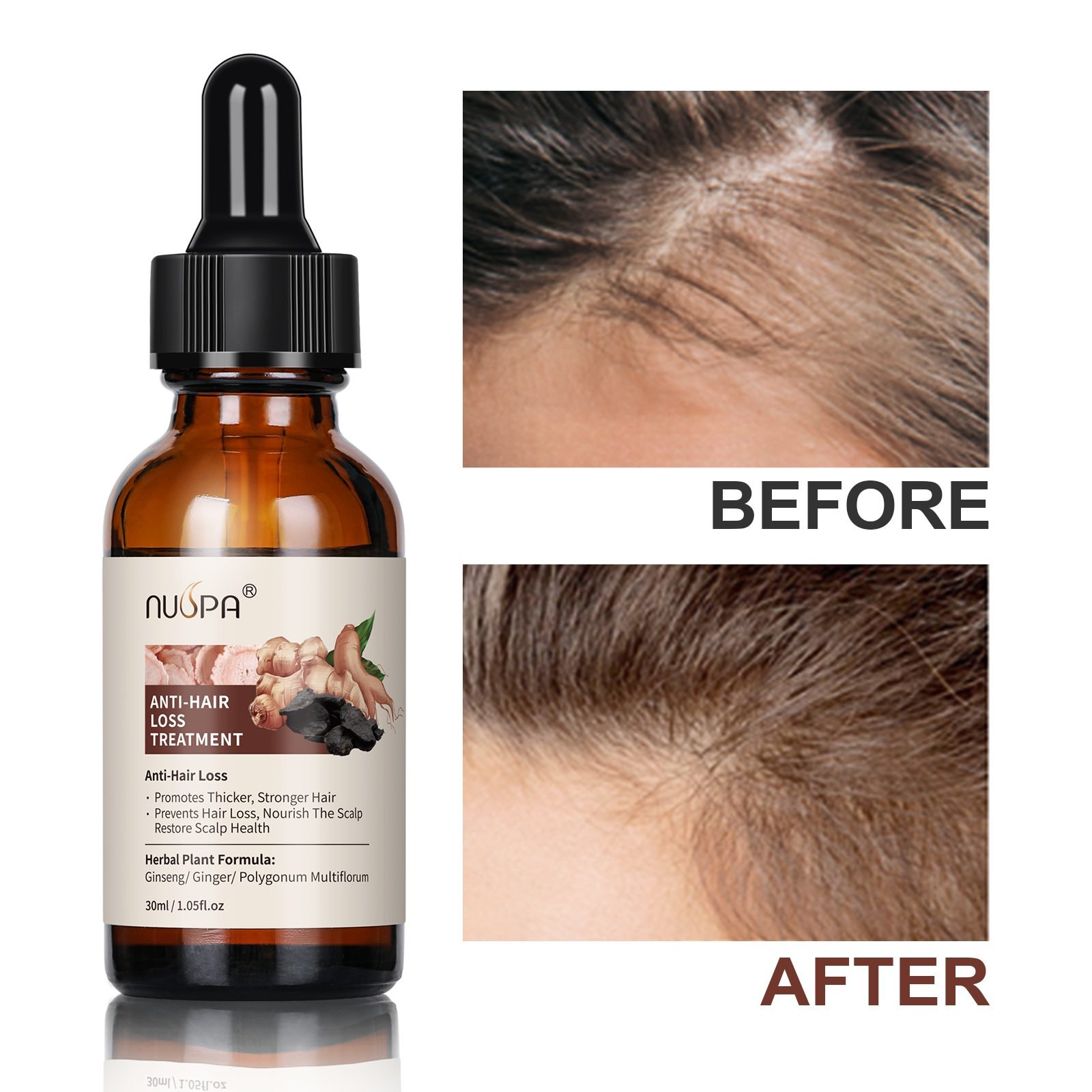 Anti-Hair-Loss Treatment Series