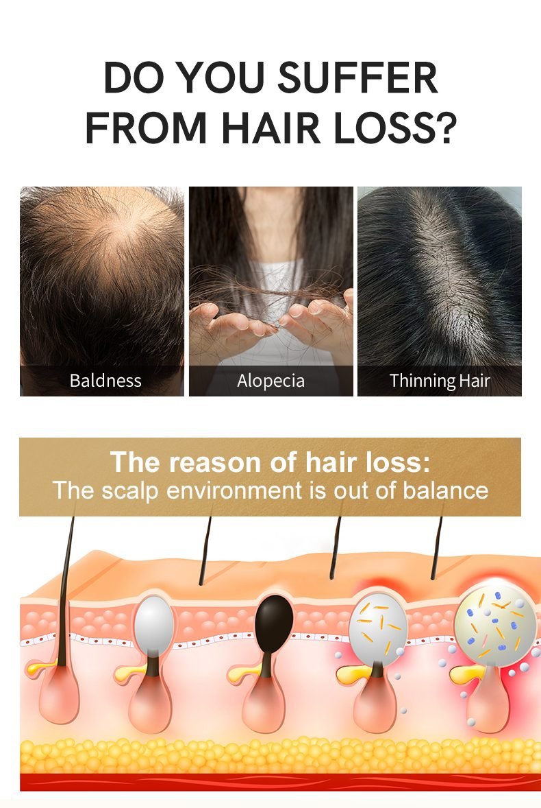 NUSPA Anti-Hair-Loss Ampoule