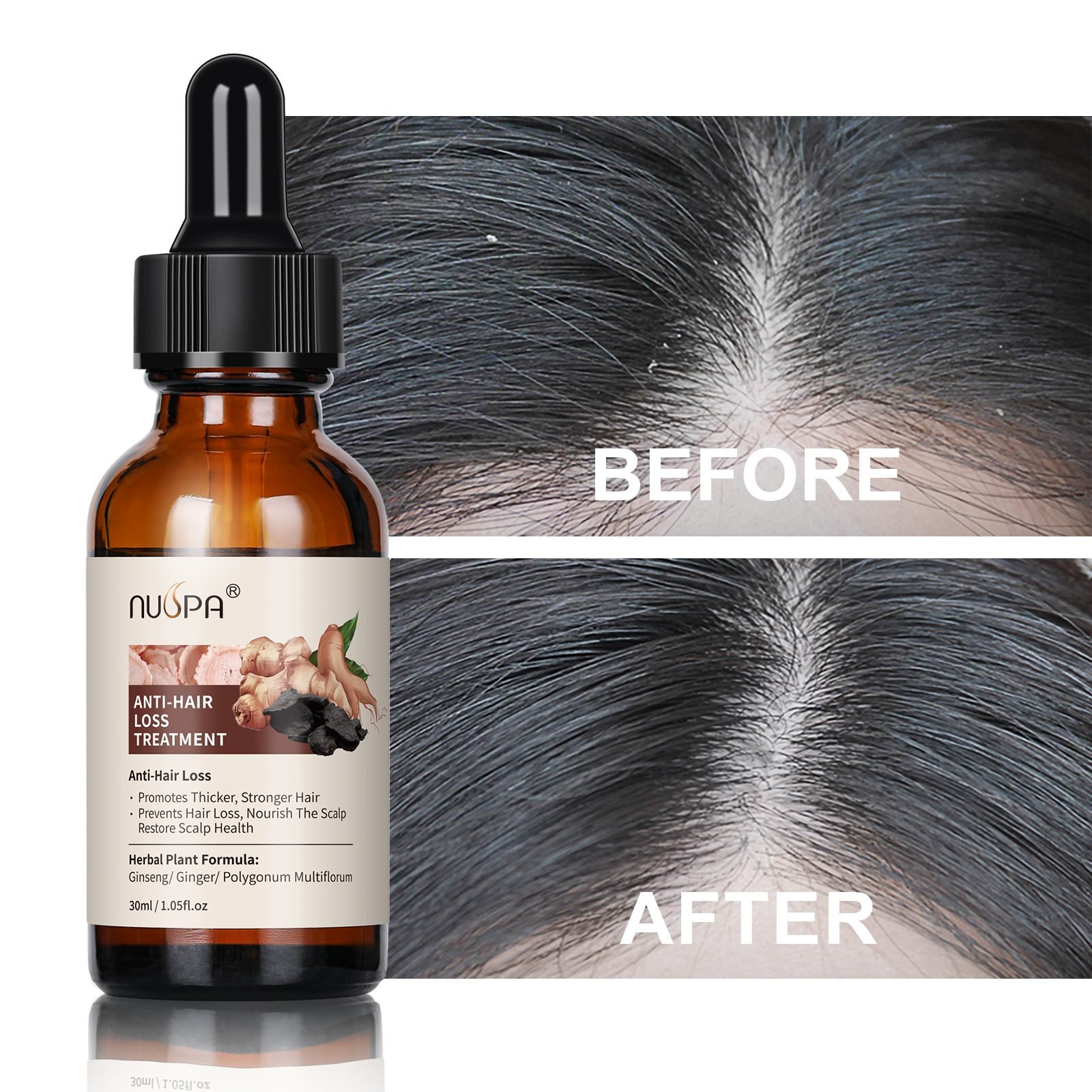 Anti-Hair-Loss Treatment Series