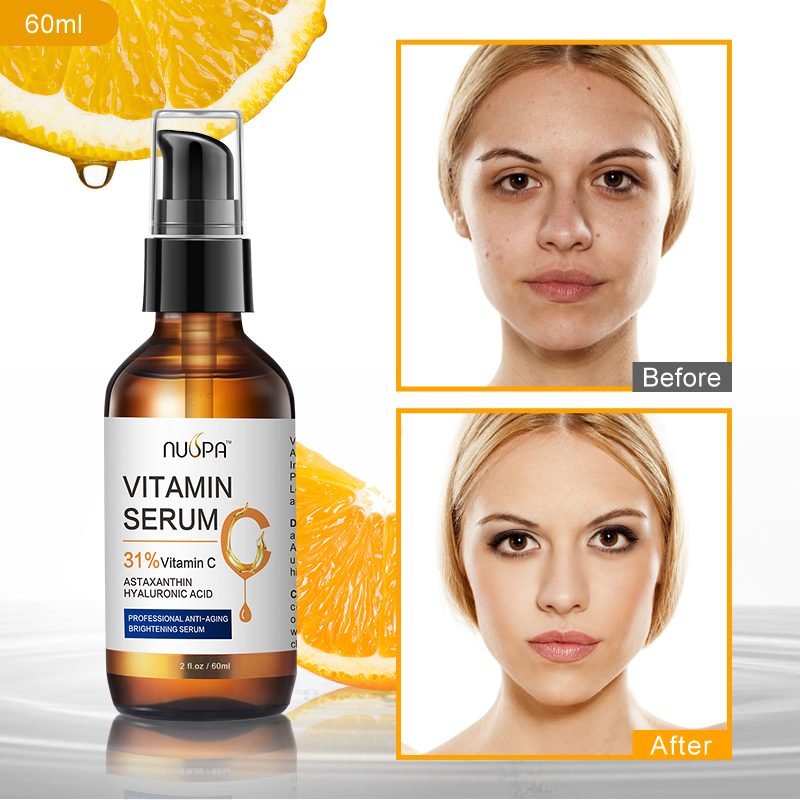 NUSPA Vitamin C Facial Serum (31% Vitamin C)