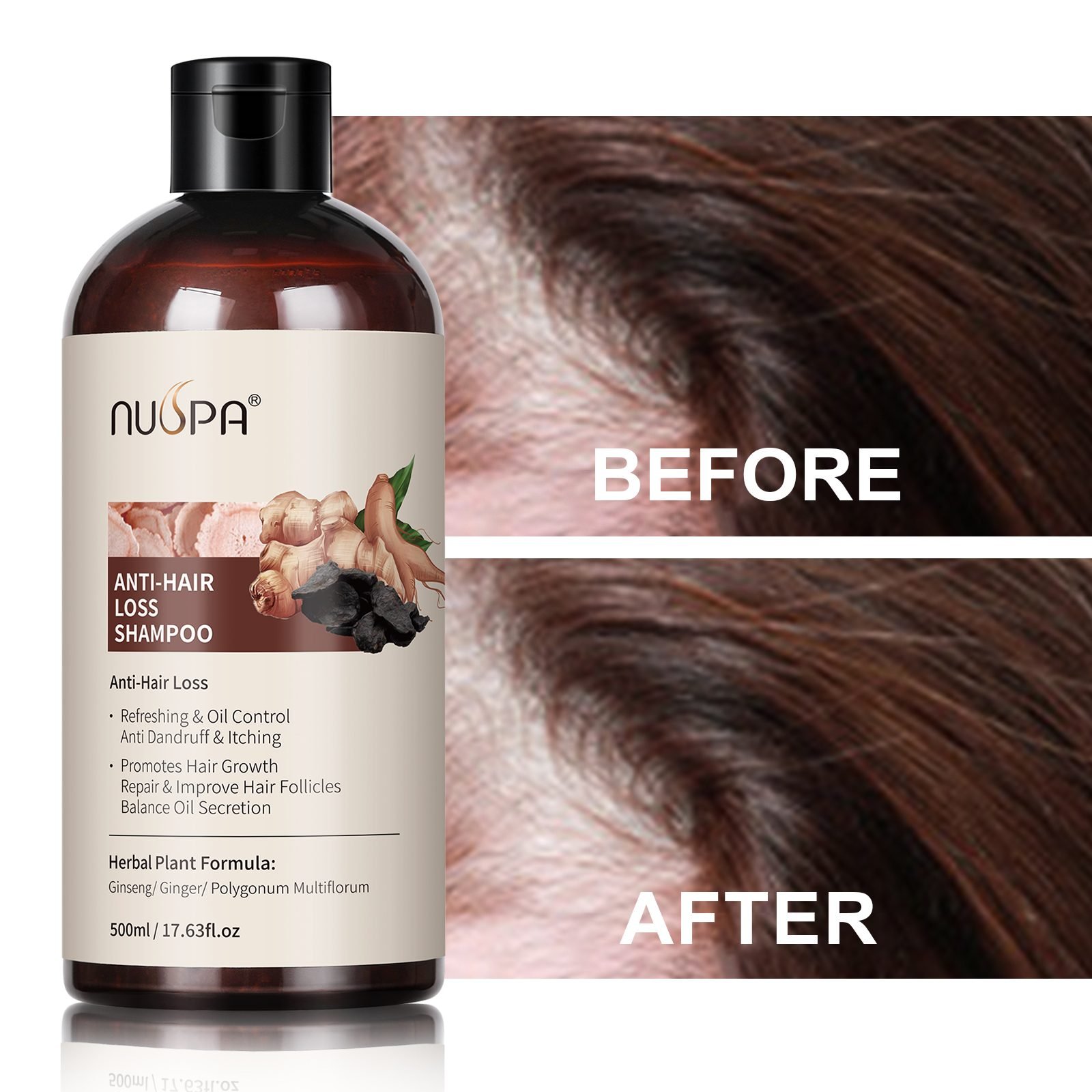 Anti-Hair-Loss Treatment Series