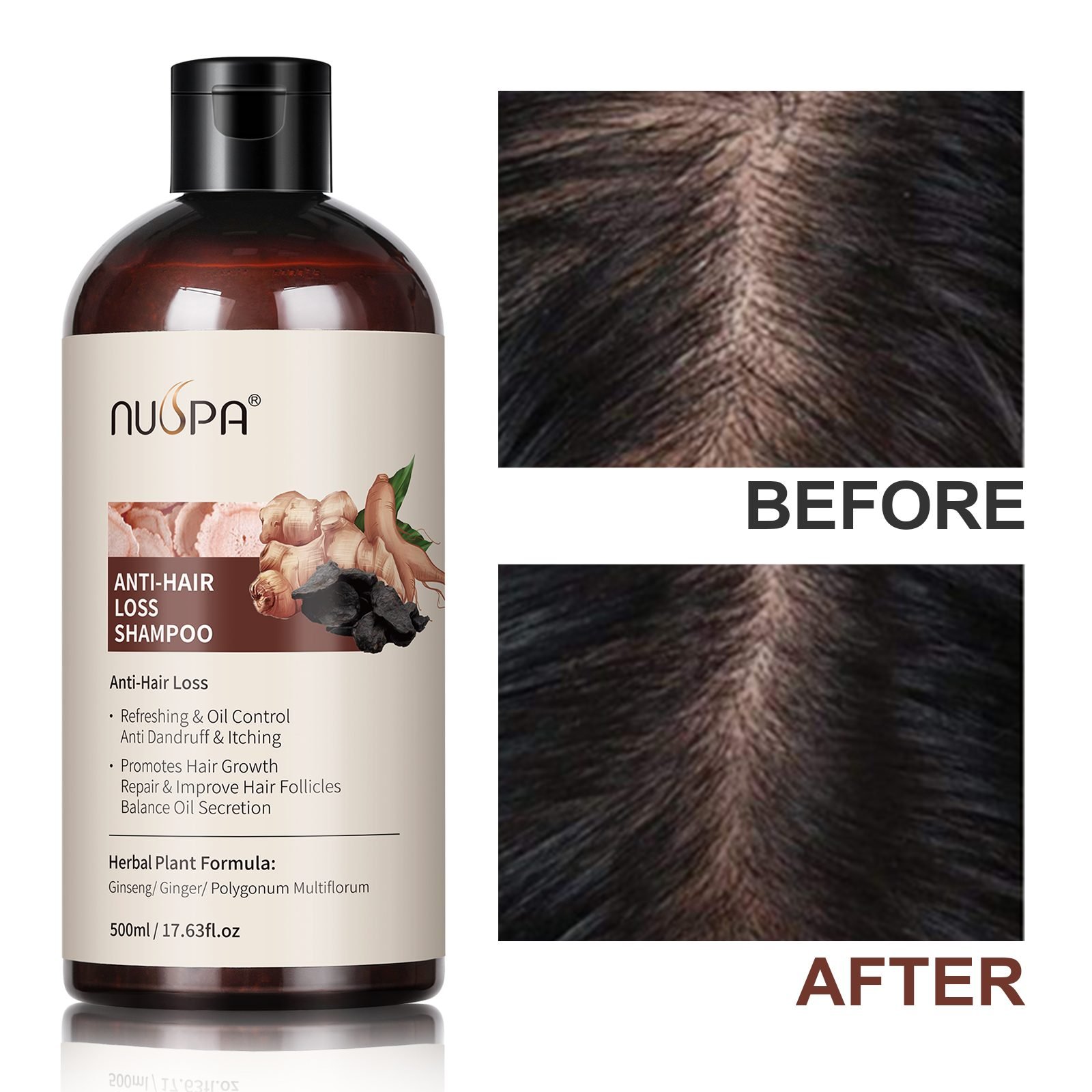Anti-Hair-Loss Treatment Series