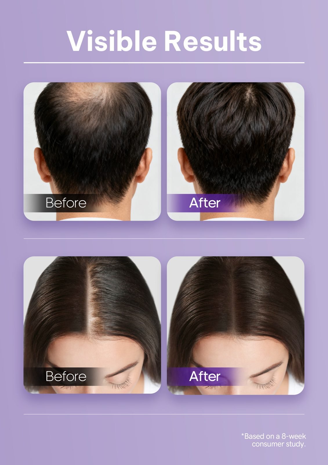 Anti-Hair-Loss Ampoule Vial Series