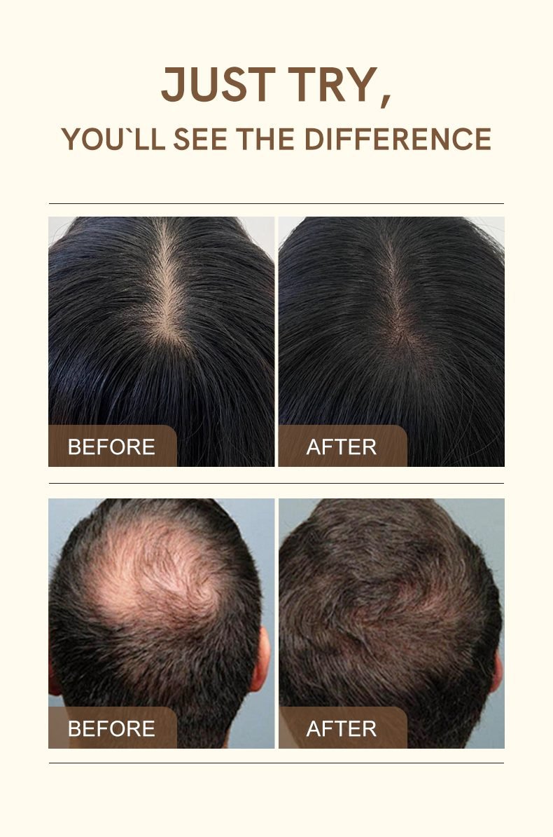 NUSPA Anti-Hair-Loss Ampoule