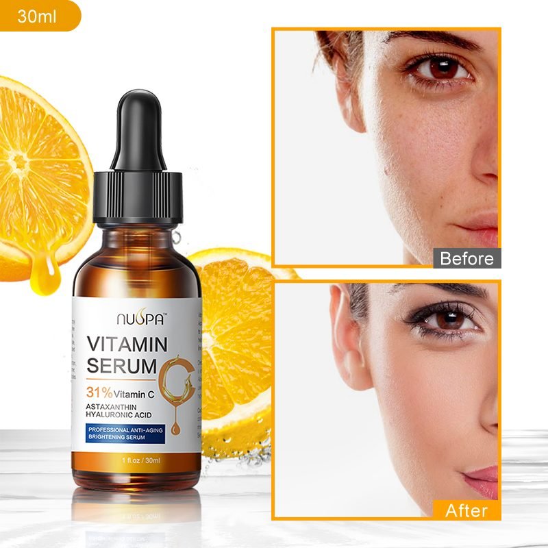 NUSPA Vitamin C Facial Serum (31% Vitamin C)